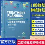 口腔修復和種植修復治療計劃